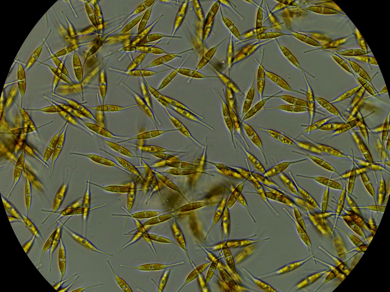 Bild von Bakterien unter dem Mikroskop.